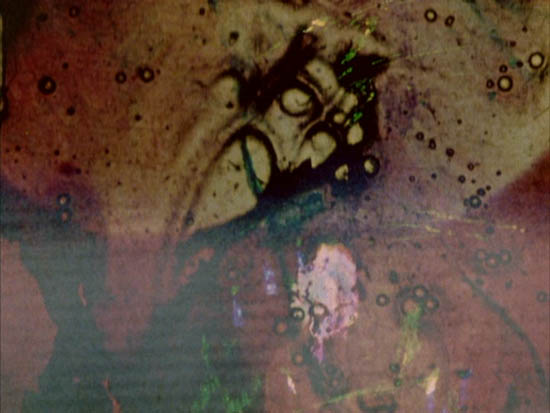 image missing
